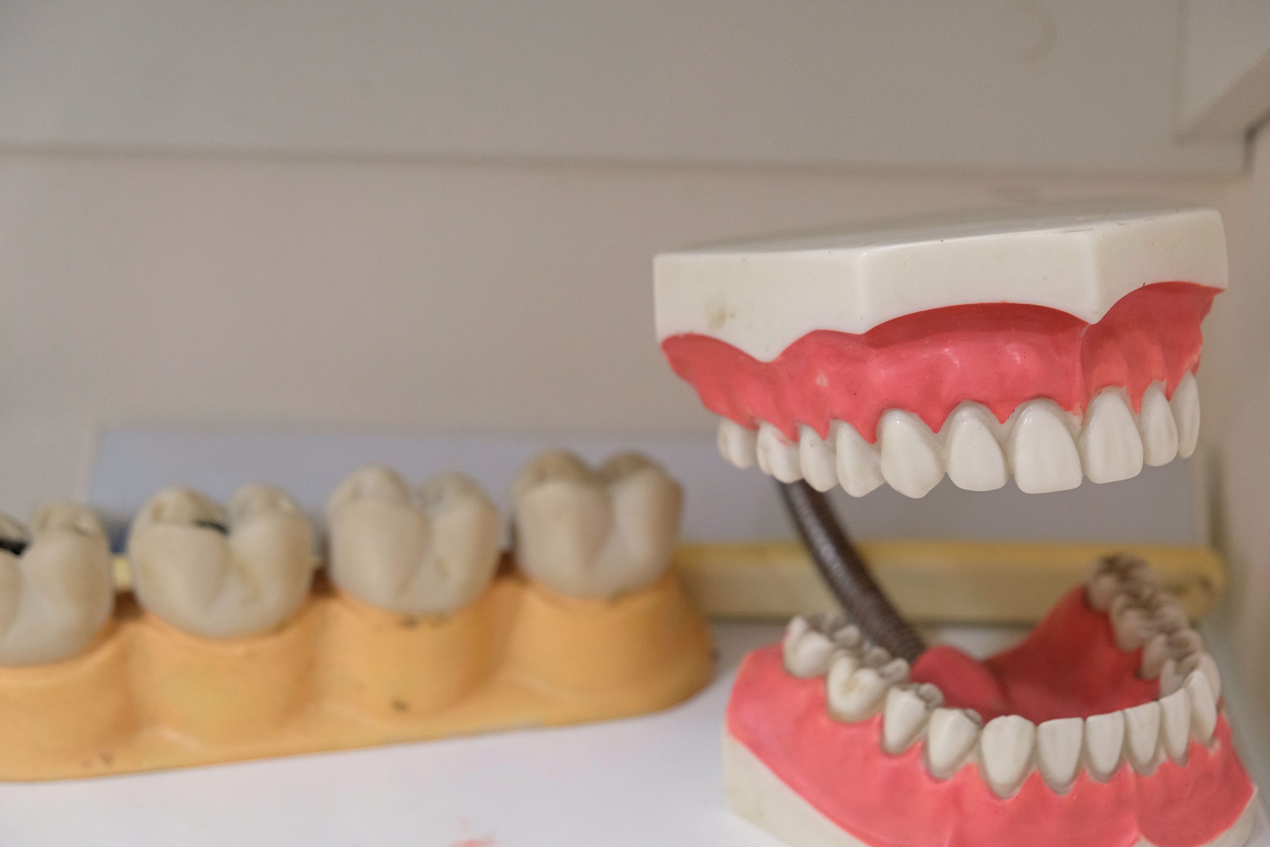 Modèles dentaires et dentiers sur présentation
